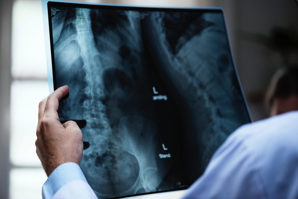 A doctor reviewing a medical x-ray.